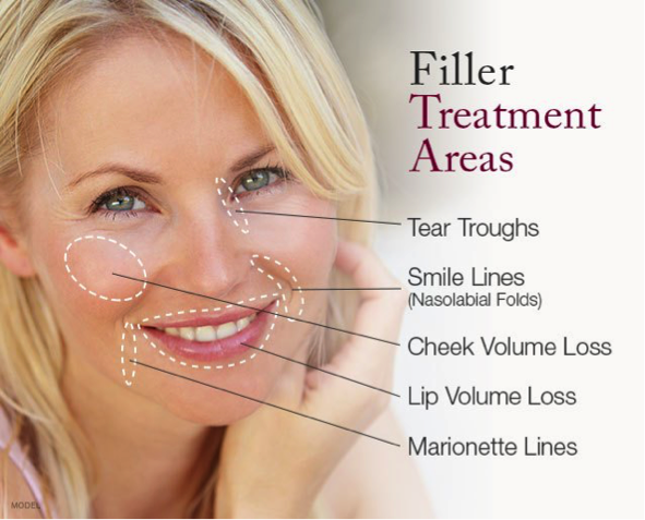 Filler Treatments 
